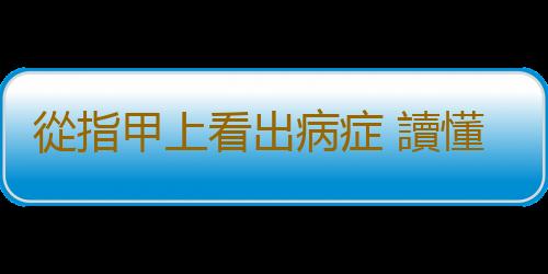 從指甲上看出病症 讀懂指甲信息了解健康狀況